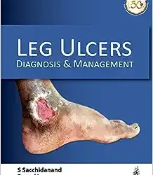 Leg Ulcers: Diagnosis and Management 1st Edition