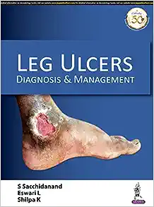 Leg Ulcers: Diagnosis and Management: Diagnosis & Management