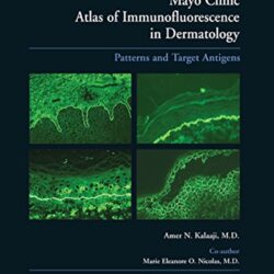 Mayo Clinic Atlas of Immunofluorescence in Dermatology: Patterns and Target Antigens 1st Edition