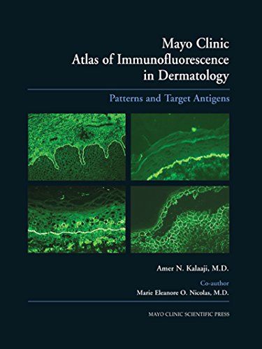 Mayo Clinic Atlas of Immunofluorescence in Dermatology: Patterns and Target Antigens