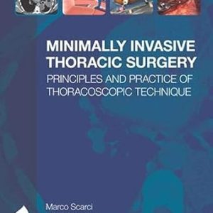 Minimally Invasive Thoracic Surgery_ Principles and Practice of Thoracoscopic Technique, 1st Edition