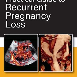 Practical Guide to Recurrent Pregnancy Loss 1st Edition