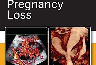 Practical Guide to Recurrent Pregnancy Loss 1st Edition