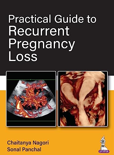 Practical Guide to Recurrent Pregnancy Loss 1st Edition