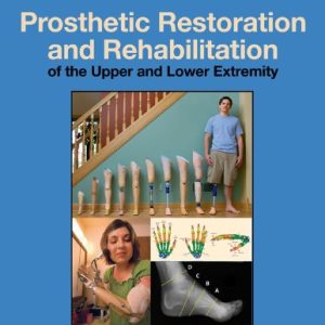 Prosthetic Restoration and Rehabilitation of the Upper and Lower Extremity 1st Edition