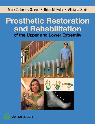 Prosthetic Restoration and Rehabilitation of the Upper and Lower Extremity 1st Edition