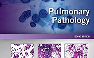 Pulmonary Pathology: A Volume in the Series: Foundations in Diagnostic Pathology 2nd Edition