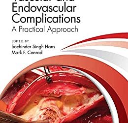Vascular and Endovascular Complications: A Practical Approach