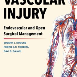 Vascular injury, endovascular and Open Surgical Management