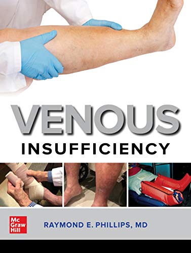 Venous Insufficiency by Raymond Philips