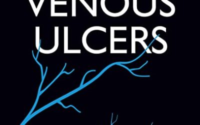 Venous Ulcers 2nd Edition, Second ed
