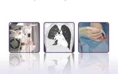 Challenging Concepts in Critical Care: Cases with Expert Commentary (Challenging Cases)