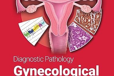 Diagnostic Pathology: Gynecological, 3rd Edition Third ed
