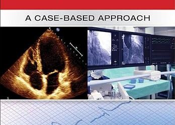 Guide to Patient Management in the Cardiac Step Down/Telemetry Unit: A Case-Based Approach 1st Edition