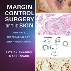 Margin Control Surgery of the Skin: Concepts, Histopathology, and Applications, 1st Edition 1E PDF