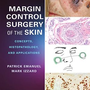 Margin Control Surgery of the Skin: Concepts, Histopathology, and Applications, 1st Edition 1E