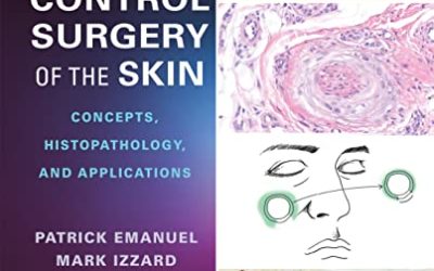 Margin Control Surgery of the Skin: Concepts, Histopathology, and Applications, 1st Edition 1E