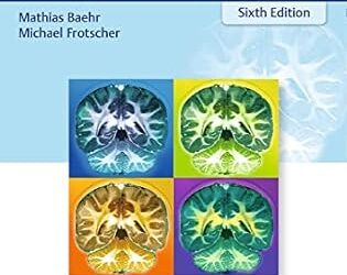 Topical Diagnosis in Neurology: Anatomy, Physiology, Signs, Symptoms 6th Edition Sixth ed
