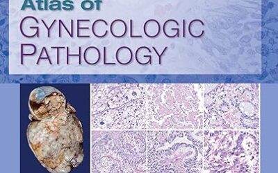 Atlas of Gynecologic Pathology A Pattern-Based Approach 1st Edition
