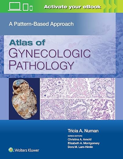 Atlas of Gynecologic Pathology A Pattern-Based Approach 1st Edition