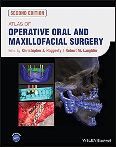 Atlas de chirurgie opératoire buccale et maxillo-faciale, 2e édition