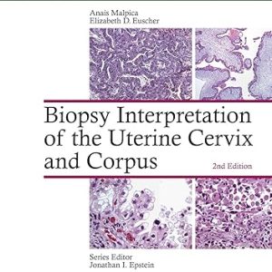 Biopsy Interpretation of the Uterine Cervix and Corpus (Biopsy Interpretation Series) Second Edition 2nd ed