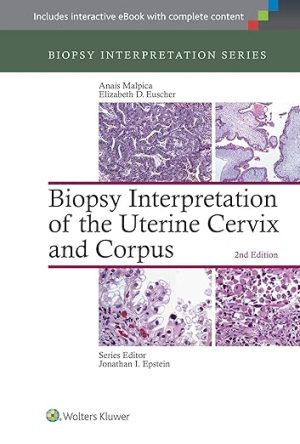 Biopsy Interpretation of the Uterine Cervix and Corpus (Biopsy Interpretation Series) Second Edition 2nd ed