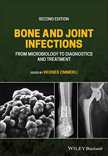 Infecções ósseas e articulares, da microbiologia ao diagnóstico e tratamento 2ª edição