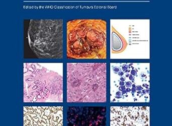 Breast Tumours WHO Classification of Tumours (Medicine) 5th Edition