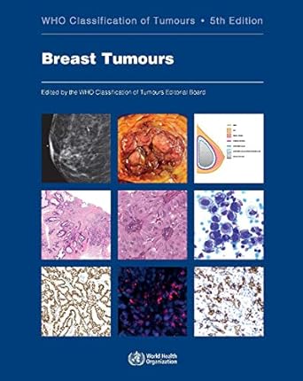 Breast Tumours WHO Classification of Tumours (Medicine) 5th Edition