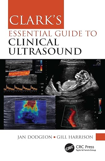 Clark’s Essential Guide to Clinical Ultrasound (Clark’s Companion Essential Guides) 1st Edition