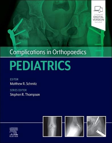 Complicações em Ortopedia Pediatria 1ª Edição