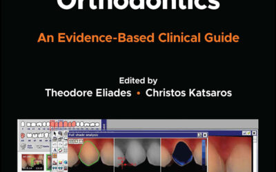 Debonding and Fixed Retention in Orthodontics (EPUB)