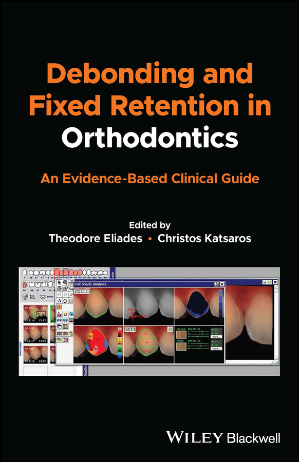 Debonding and Fixed Retention in Orthodontics (EPUB)