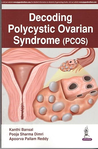 Decoding Polycystic Ovarian Syndrome 1st Edition