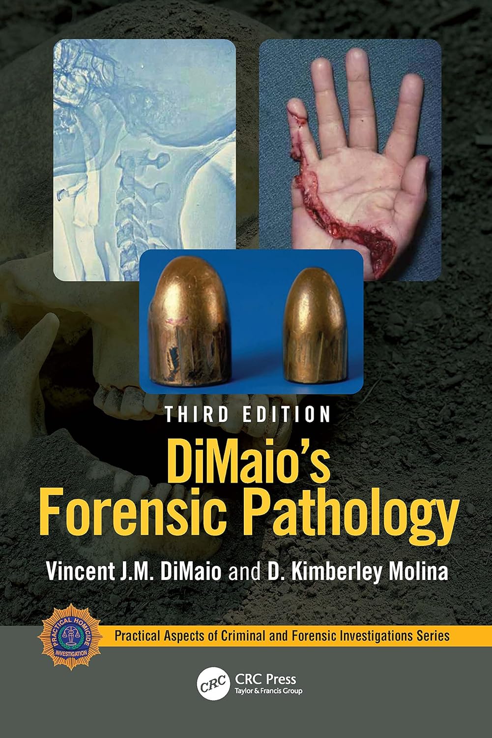 DiMaio's Forensic Pathology (Practical Aspects of Criminal and Forensic Investigations) 3rd Edition