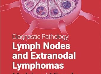 Diagnostic Pathology Lymph Nodes and Extranodal Lymphomas 3rd Edition