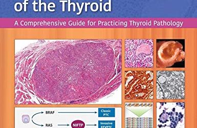 Diagnostic Pathology and Molecular Genetics of the Thyroid A Comprehensive Guide for Practicing Thyroid Pathology 3rd Edition