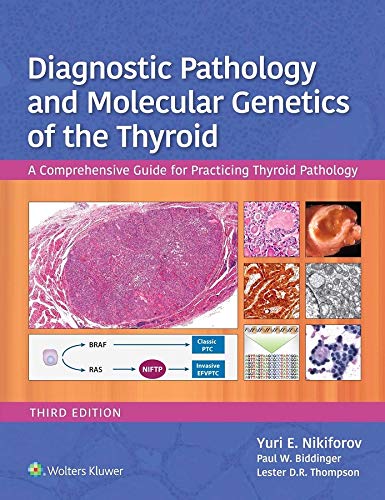 Диагностическая патология и молекулярная генетика щитовидной железы. Комплексное руководство для практикующих специалистов по патологии щитовидной железы, 3-е издание.