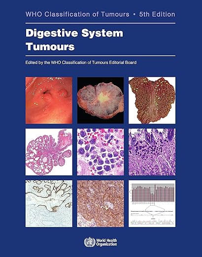 Digestive System Tumours WHO Classification of Tumours (Medicine) 5th Edition