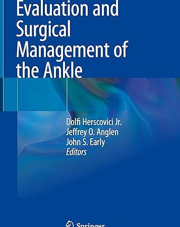 Evaluation and Surgical Management of the Ankle 1st ed. 2023 Edition