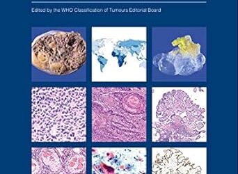 Female Genital Tumours WHO Classification of Tumours (Medicine) 5th Edition