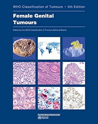 Tumores Genitais Femininos Classificação de Tumores da OMS (Medicina) 5ª Edição