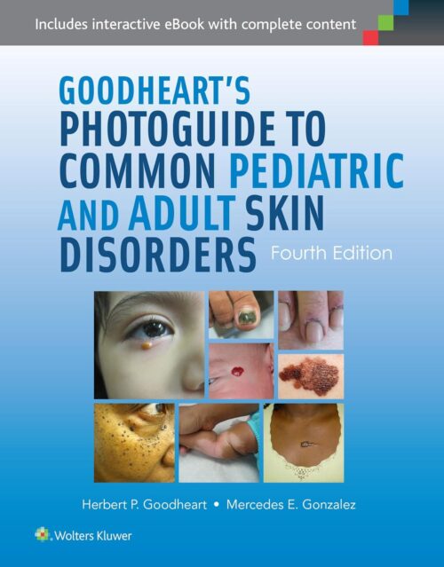 一般的な小児および成人の皮膚疾患に関するグッドハートのフォトガイド 第 4 版