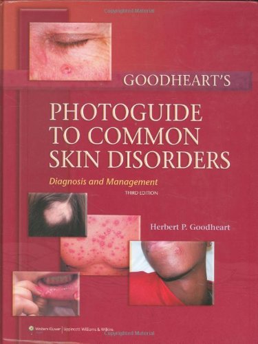 מדריך הצילום של Goodheart לאבחון וניהול הפרעות עור נפוצות, מהדורה שלישית