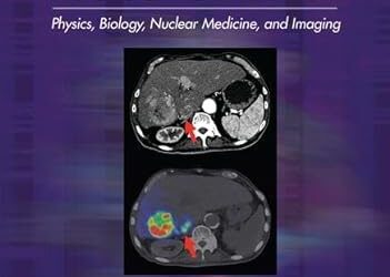 Handbook of Radioembolization Physics, Biology, Nuclear Medicine, and Imaging (Imaging in Medical Diagnosis and Therapy) 1st Edition