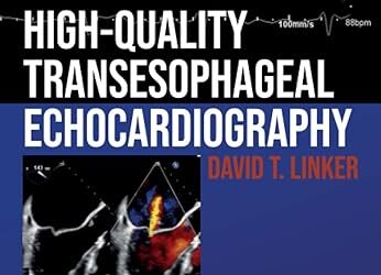High-Quality Transesophageal Echocardiography 1st Edition