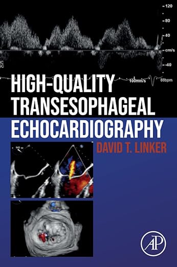 High-Quality Transesophageal Echocardiography 1st Edition