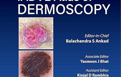 IADVL Atlas of Dermoscopy 1st Edition