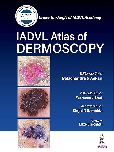 IADVL 皮膚鏡檢查圖譜第一版